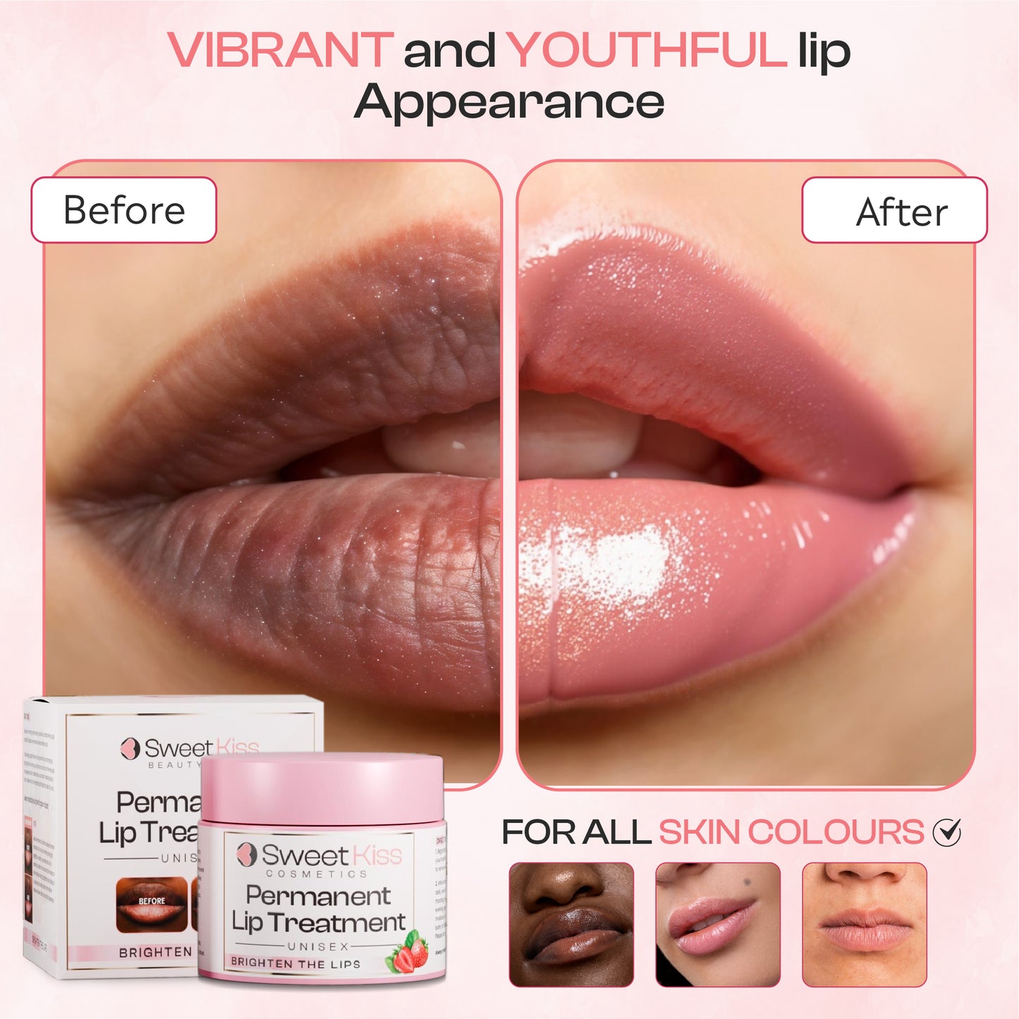 Sweet Kiss Permanent Lip Lightening Treatment – A Perfect Blend of Moisturizing Balm and Exfoliating   Grain-Like  Properties That Brighten Dark Lips|Lip Discoloration. Treatment for Smokers & Non-Smokers | Alpha Arbutin & Licorice Extract Formula